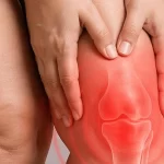 Diz biyomekaniğini bozan süreç: Lipödem