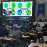 Bursa’da 50 profesörden canlı göz ameliyatı şovu